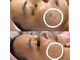 プリエール ビューティの写真