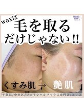 エリス(ELISSE)/毛を取るだけじゃない！