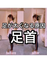カワル整体 上通り院/足が太くなる原因