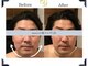 コリアンビューティーサロンリー(Lee)の写真
