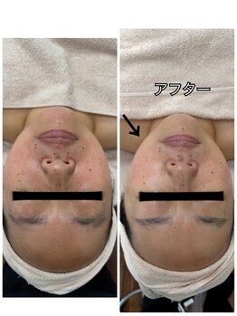 ジャスミン(Jasmin)/小顔マッサージ付きシェービング