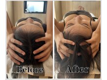 整体ラルース 中目黒(LALUZ)/20代 女性 小顔ヘッドスパ　変化