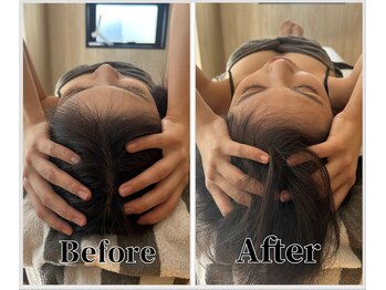 整体ラルース 中目黒(LALUZ)/20代 女性 小顔ヘッドスパ 変化