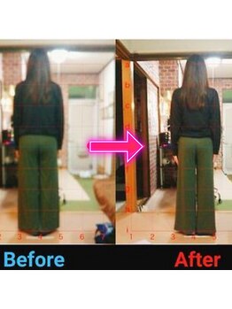 サプライズ整体院/20代ママさんの産後の骨盤初回