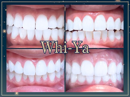 ホワイヤ セルフホワイトニング DBS神楽坂(Whi-Ya)の写真