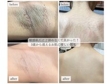 ミーラブ 鹿児島(miilove)の雰囲気(ここで脱毛してよかった!のお声が私たちスタッフのやりがいです)