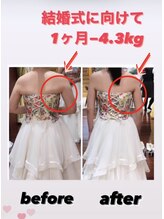 クラフト(CRAFT)/ビフォーアフター