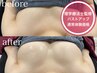 【バストアップ】痛みの少ない施術！美乳BODYMAKE(体験価格) ¥12,000