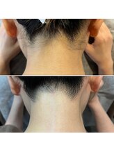 シャンティ(Shanti)/うなじ美人