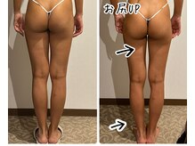 エステティックサロン アンジュ(Ange)/美脚＆美尻が手に入ります！