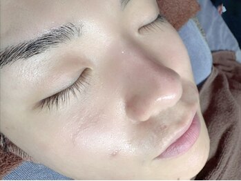 ニューフェイス(NEW FACE)の写真/毛穴洗浄と眉メニューの同時施術OK◎毎日のお手入れも楽ちん♪メンズ特有のお肌のお悩みはプロにお任せ！
