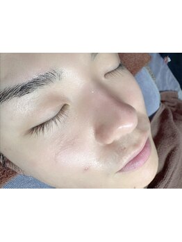 メンズフェイシャル