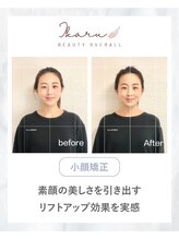 イカル 池袋(ikaru)/小顔矯正 before after 