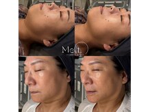 メルト 中目黒(Melt.)の雰囲気（引き締め、お任せください♪）