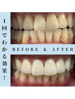 ドルチェ 水戸店(Dolce)/★ before → after ★