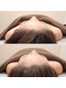【小顔メソッド式頭皮デトックス】極上リンパマッサージによる究極デトックス