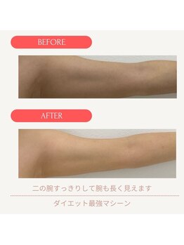 ミーティア(Meteor)/