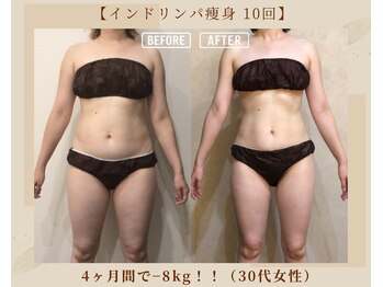 オキシー グレイス 黒崎店(OXY Grace)/インドリンパ痩身