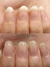 マリーロール 淀屋橋本店(Marie Laure)/自爪育成/深爪矯正/ネイルケア