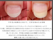 ウールー(heureux)/爪育その2