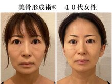 ドクターボディクリスタル(Dr.Body Crystal)の雰囲気(【間延び感/フェイスラインのもたつき/顔の大きさ】引き締り◎)