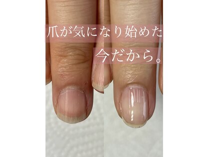 ソラ ビューティールーム(SORA beauty room)の写真