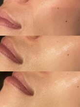 ビュウナ 銀座(BEAUNA)/アルティメットパルス