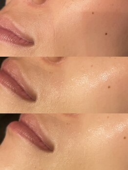 ビュウナ 銀座(BEAUNA)/アルティメットパルス