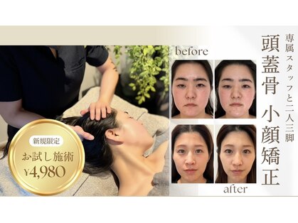 アルフォービューティー 広島店(ALU for beauty)の写真