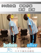 たすき鍼灸院 浦和/50代女性　腰痛・膝痛