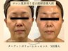 【NEW】ハリ肌へ!ターゲットボリュームフェイシャル 60分