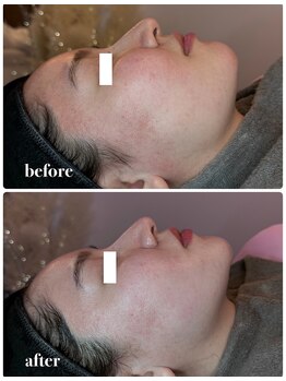 ウルラ(ULULA)/浮腫も余白もぶっ飛ばせ!