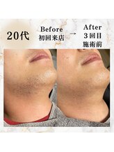 コミチ(KOMICHI)/ビフォーアフター