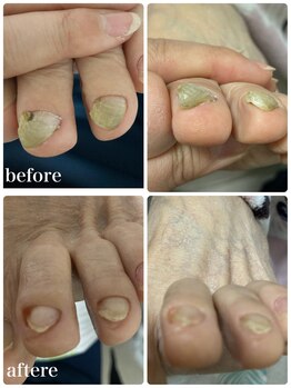 爪屋/厚い爪も1回のケアで綺麗に