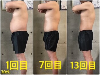 ペリー(PELLY)/男性30代 before after