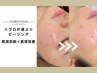 【肌質改善】≪プロが選ぶ≫肌質診断×肌質改善　ぴったりのメニューを提案