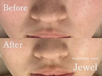 ジュエル(Jewel)/マグマハーブ一回の効果