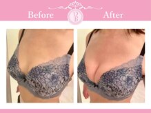 デミーナ(Demyna)の雰囲気（理論に基づく根本施術2カップUP続出/バストアップの概念が変わる）