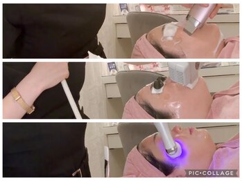 アゼリア 本厚木店(AZALEA)/毛穴洗浄×顔脱毛×美容液導入