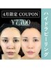 【5月限定でお得】毛穴洗浄ハイドラ全顔ピーリング！透明感UPの美肌ケア体験