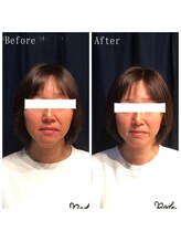 たくろう鍼灸院 豊田本院/Before＆After