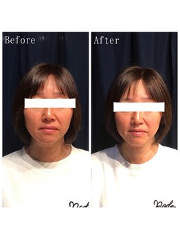 たくろう鍼灸院 豊田本院/Before&After