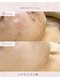 ディシエル(D'ciel)の写真/ニキビ.跡.毛穴.お肌トラブルでお悩みの方.何をしても変わらなかった方