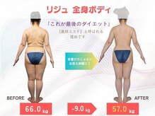 エステ ステーション 神戸三宮店の雰囲気(リジュ全身ボディ体験 体重・他死亡だけじゃなく肌質も↑)