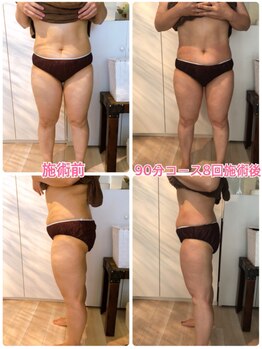 プライベートサロン レイ(Ray)/全身痩身コース90分4回×約2ヶ月