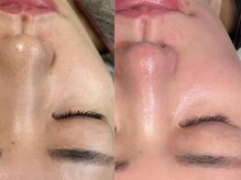 カラーズ(COLOURS)/毛穴ケア/シミ・しわ改善に◎