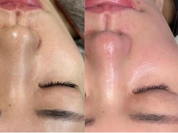 カラーズ(COLOURS)/毛穴ケア/シミ・しわ改善に◎