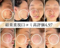 ドクタースキン(Dr.skin)