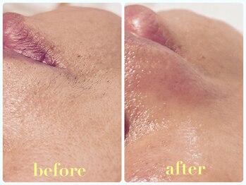 ベルドア(Bell Door)/産毛Wax