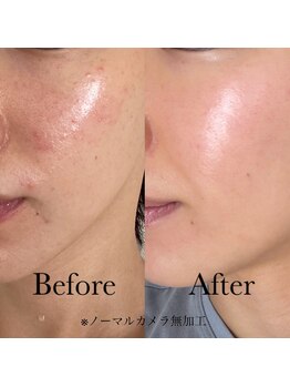 リンク(Link)の写真/<衝撃の変化>原因不明の肌悩みから解放！専門家が厳選した美容化粧品で理想のツヤ美白肌へ導く◎